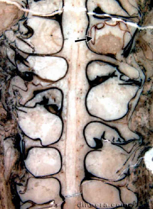 Mazocarpon oedipternum 01 cc